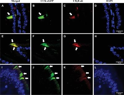 Cannabinoid CB1 Receptors Inhibit Gut-Brain Satiation Signaling in Diet-Induced Obesity